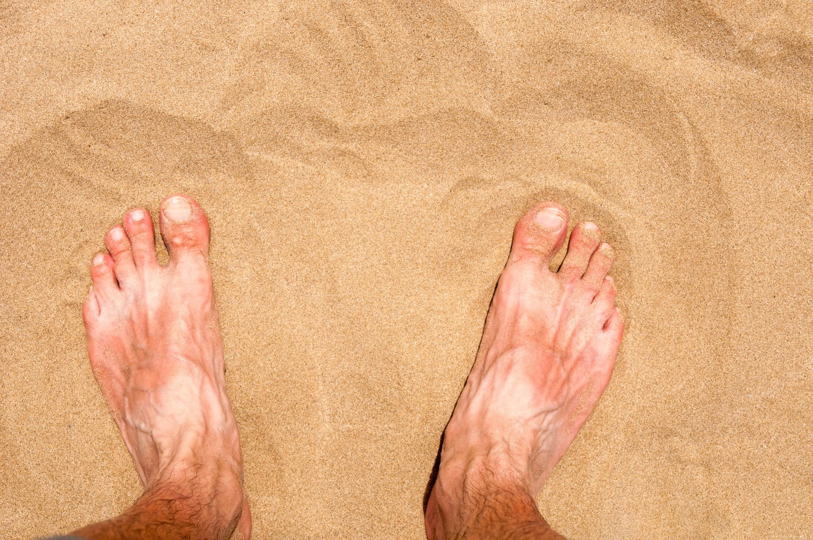 Seis causas para a pele dos pés estar a soltar-se